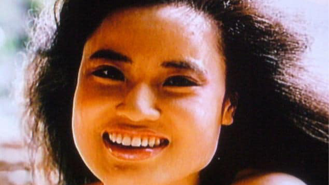Hang Mioku's picture before the surgery.