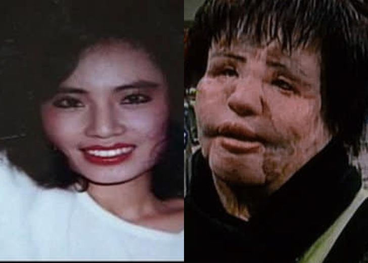 What Is Hang Mioku Doing Now? Plastic Surgery Took Her Close to Death