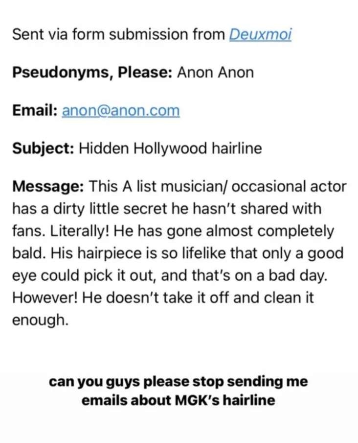 The rumor regarding Harry Styles being bald due to hair loss started from DeuxMoi.