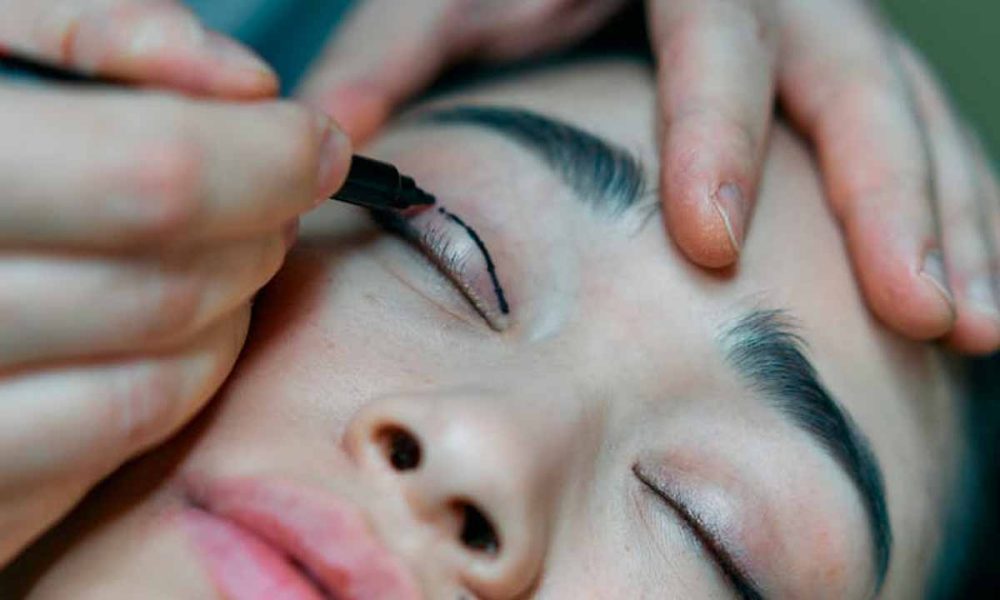 Top Considerations to Know Before Your Eyelid Surgery