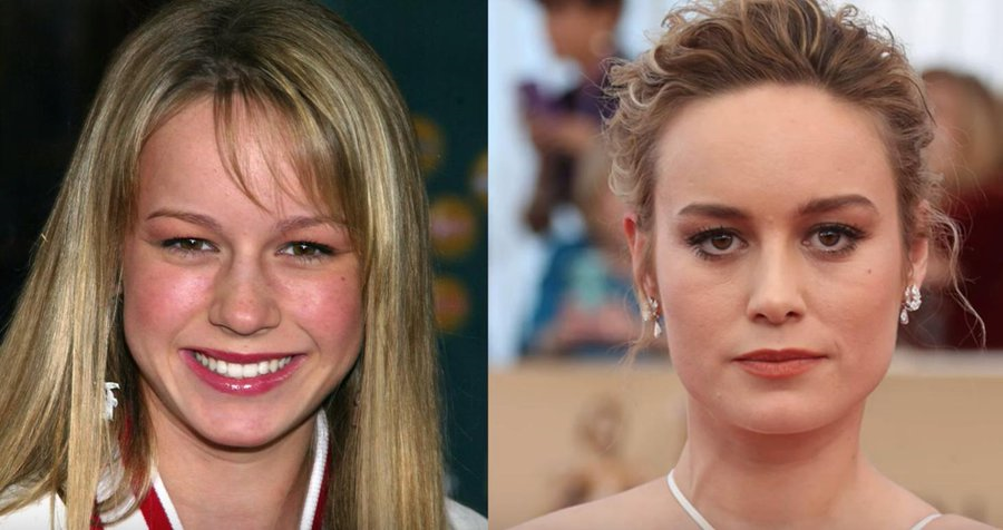 Brie Larson before and after picture of alleged nose job.
