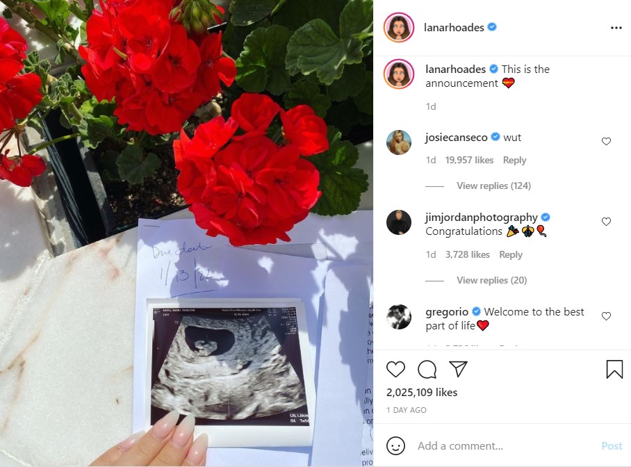 Lana Rhoades announcing her baby by revealing the picture of sonogram.
