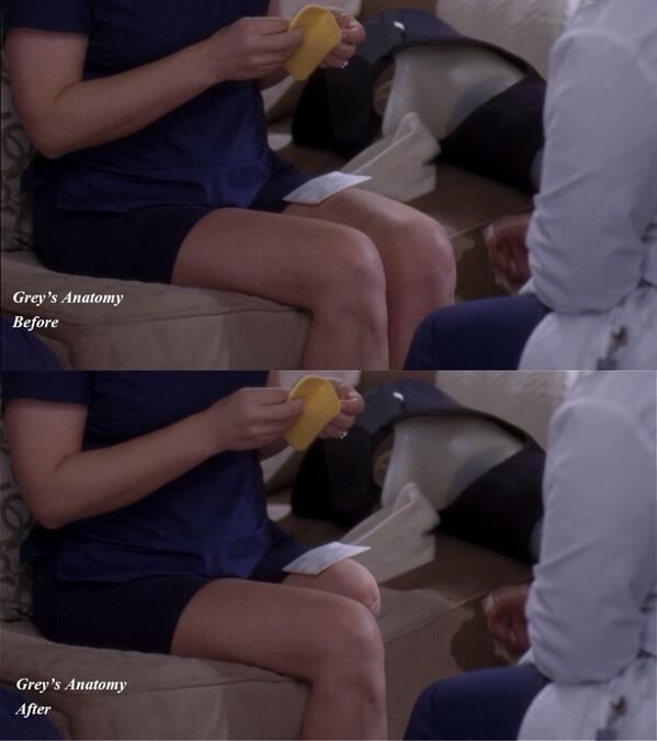Jessica Capshaw's Dr. Arizona Robbins's leg before and after using CGI in 'Grey's Anatomy'