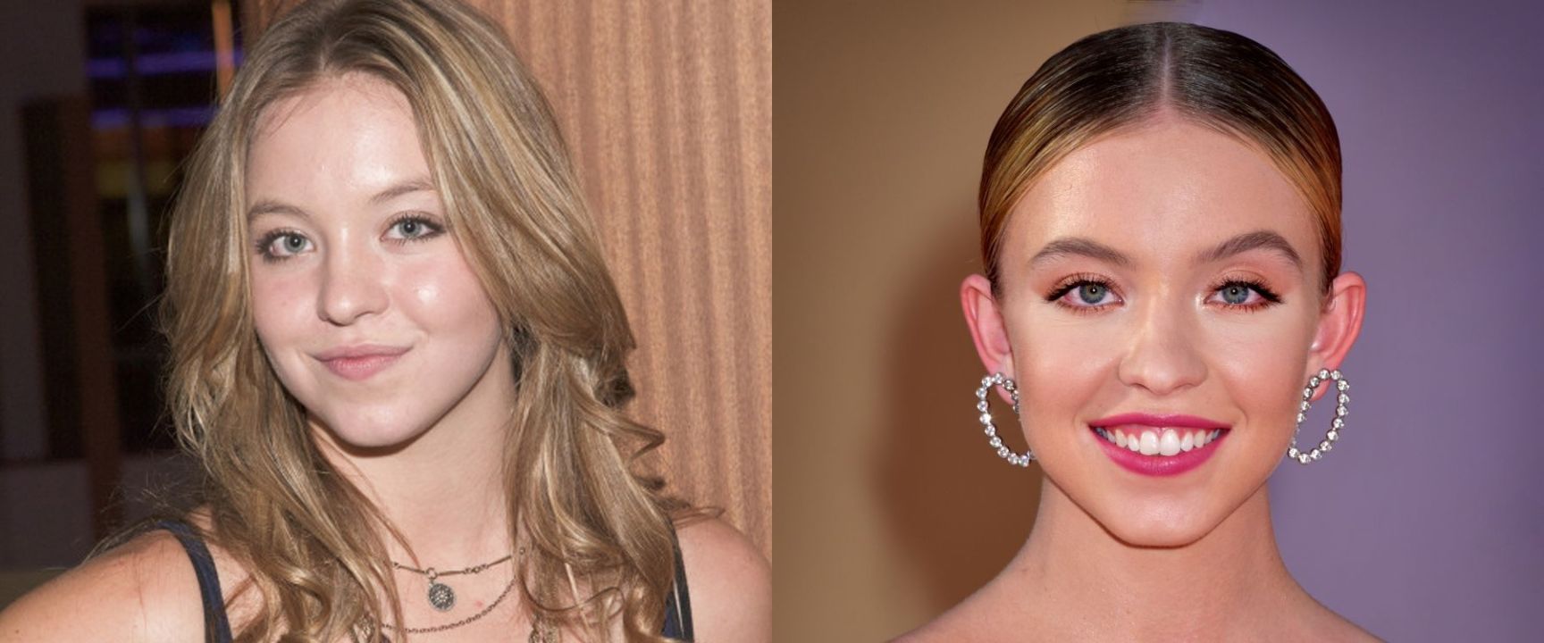 Sydney Sweeney's before and after pictures