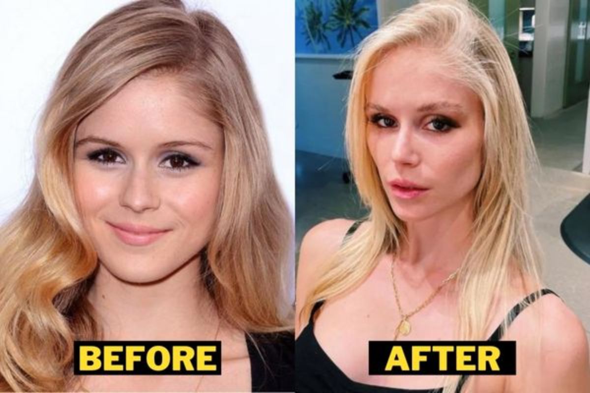 Erin Moriarty before and after her alleged plastic surgery