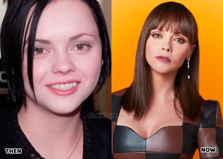 Christina Ricci Opens Up About Her Plastic Surgery At Age 19