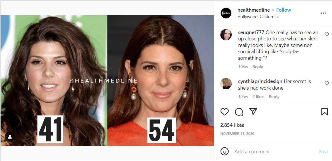 A health/beauty account compared Marisa Tomei while she was in her early 40s and mid-50s 
