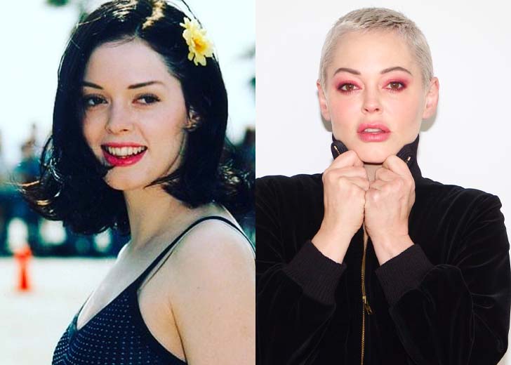 Actress Rose McGowan’s Real Plastic Surgery Reason Leaked