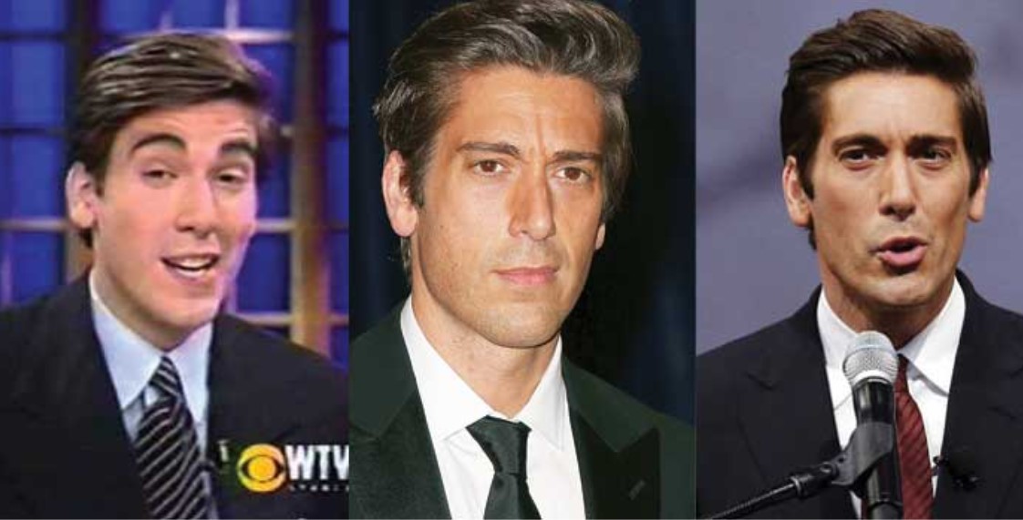 David Muir's nose appeared slightly different in the before and after photos.