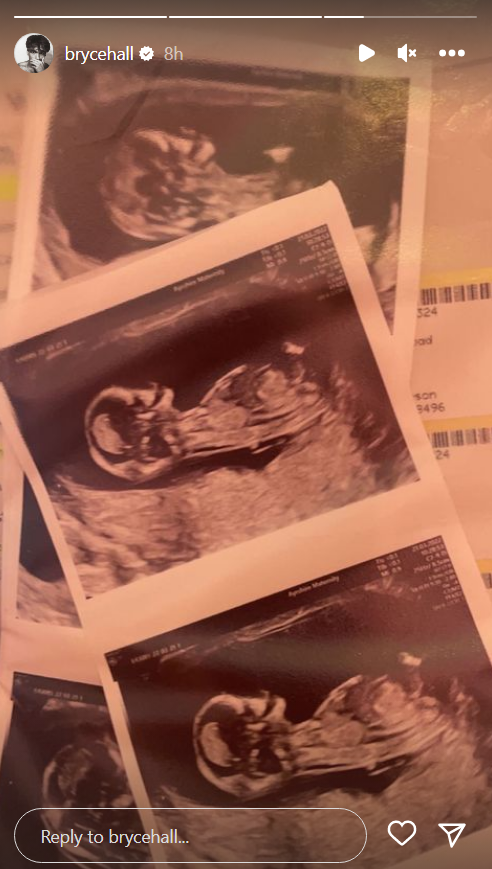 Bryce Hall posted ultrasound scans of a baby. 