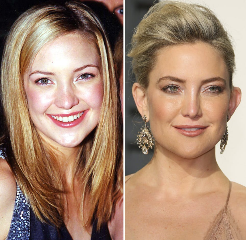 Kate Hudson before and after. 