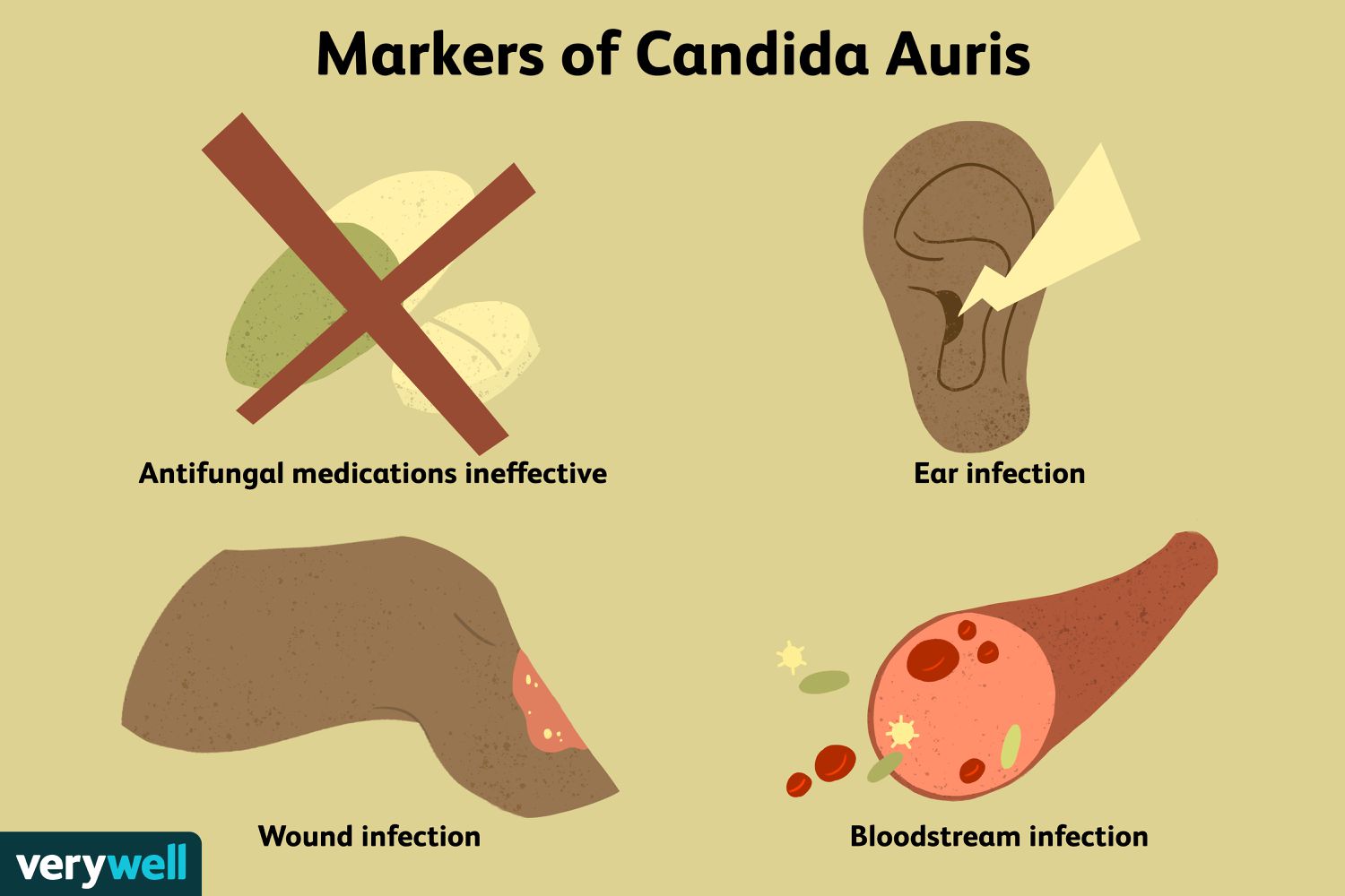Visual representation of markers of Candida auris