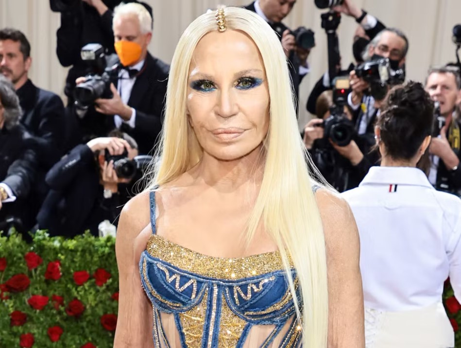 Experts believe Donatella Versace had extensive cosmetic surgery. 