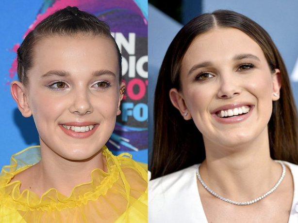 Millie Bobby Brown before and after pictures. 