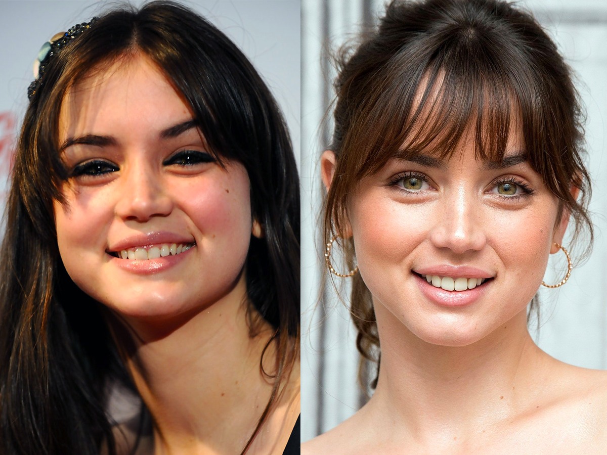Ana De Armas has been accused of getting plastic surgery.