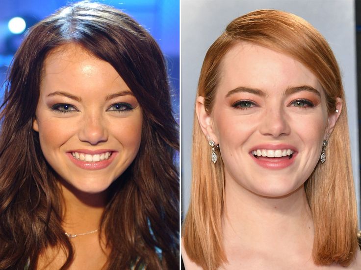 Emma Stone's before and after picture.