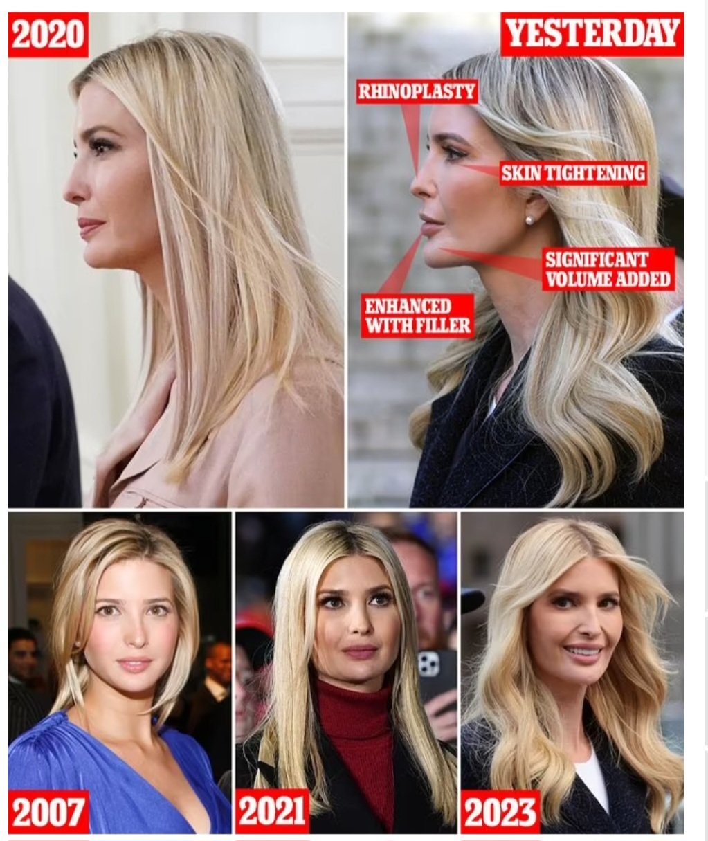 Ivanka Trump has been accused of getting plastic surgery by comparing before and after photos of her. 