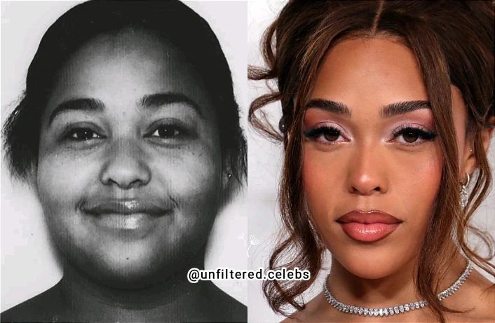 Jordyn Woods before and after.