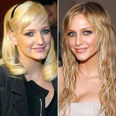 Ashlee Simpson before and after her nose job