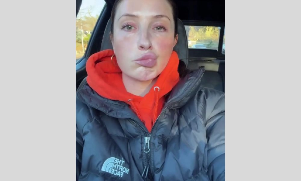 Bristol Palin Reveals New Treatment Plan for Facial Paralysis During Grim New Year Update